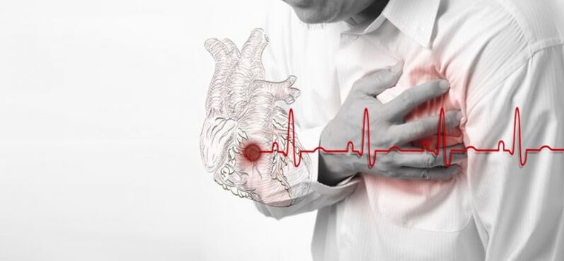 atac de cord ca cauză a durerii sub omoplatul stâng
