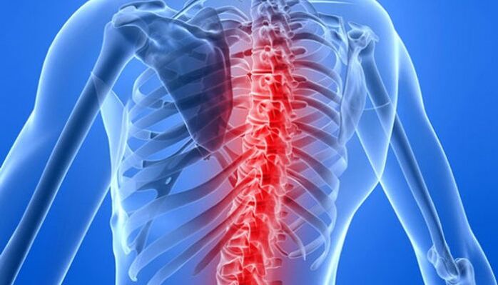 Patologiile coloanei vertebrale sunt cele mai frecvente cauze ale durerilor de spate în zona omoplatului