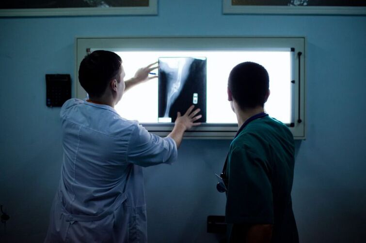 Diagnosticul de artroză pe x -ray