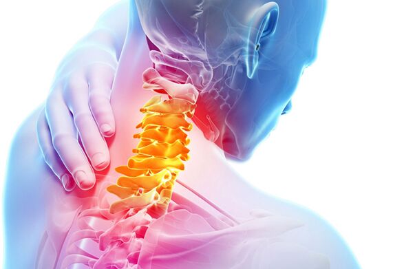 Osteocondroza cervicală