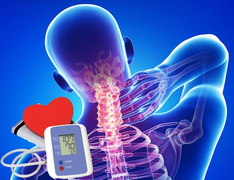 Sări ale tensiunii arteriale cu osteocondroză cervicală