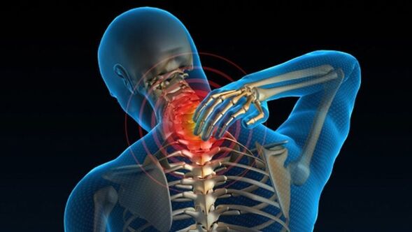 Durerea la întoarcerea gâtului poate indica sindromul de osteocondroză cervicală vertebrală